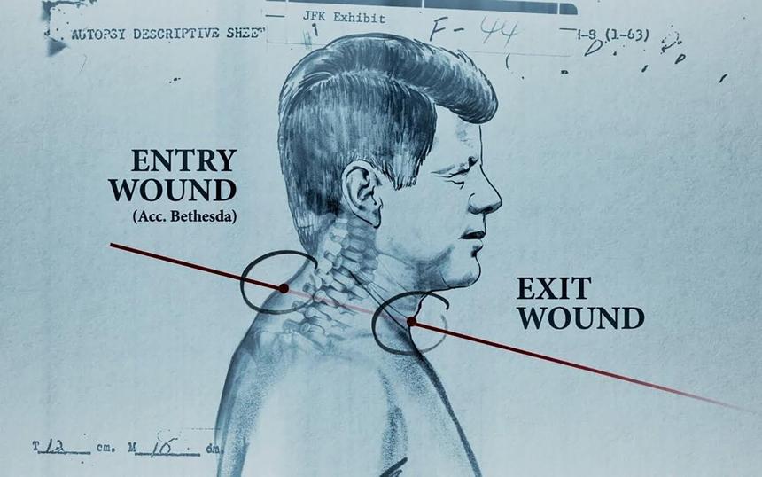 «Кеннеди: Что видели врачи»