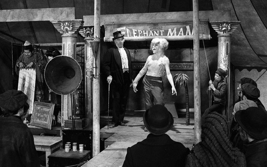 «Человек-слон»