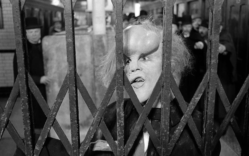 «Человек-слон»